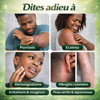 Traitement qui élimine définitivement l'eczéma, le psoriasis et les démangeaisons