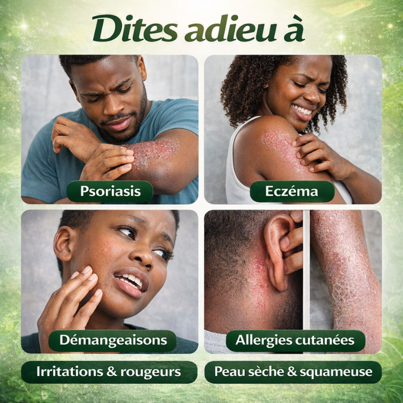 Traitement qui élimine définitivement l'eczéma, le psoriasis et les démangeaisons