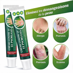 Traitement qui élimine définitivement l'eczéma, le psoriasis et les démangeaisons