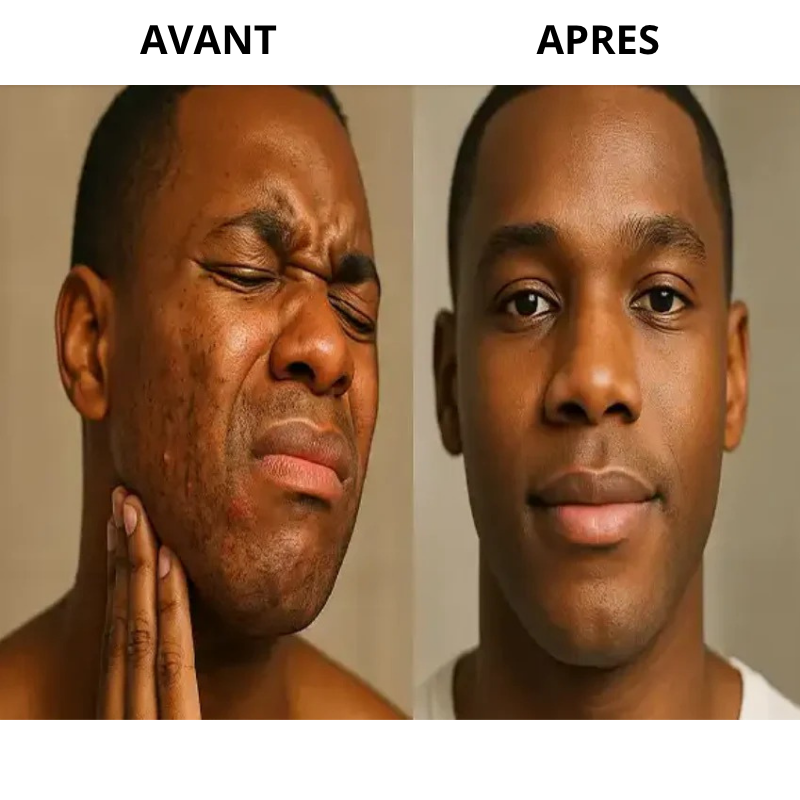 Sérum Hydratant anti Boutons & poils incarnés