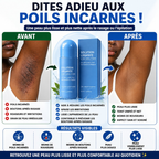 Sérum Hydratant anti Boutons & poils incarnés