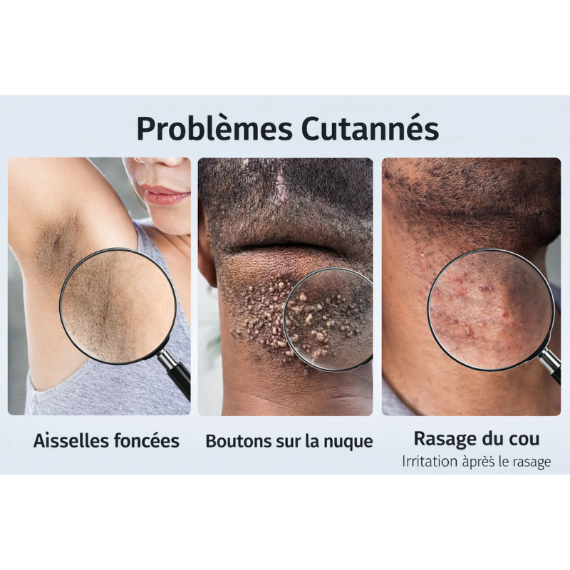 Sérum Hydratant anti Boutons & poils incarnés