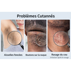 Sérum Hydratant anti Boutons & poils incarnés