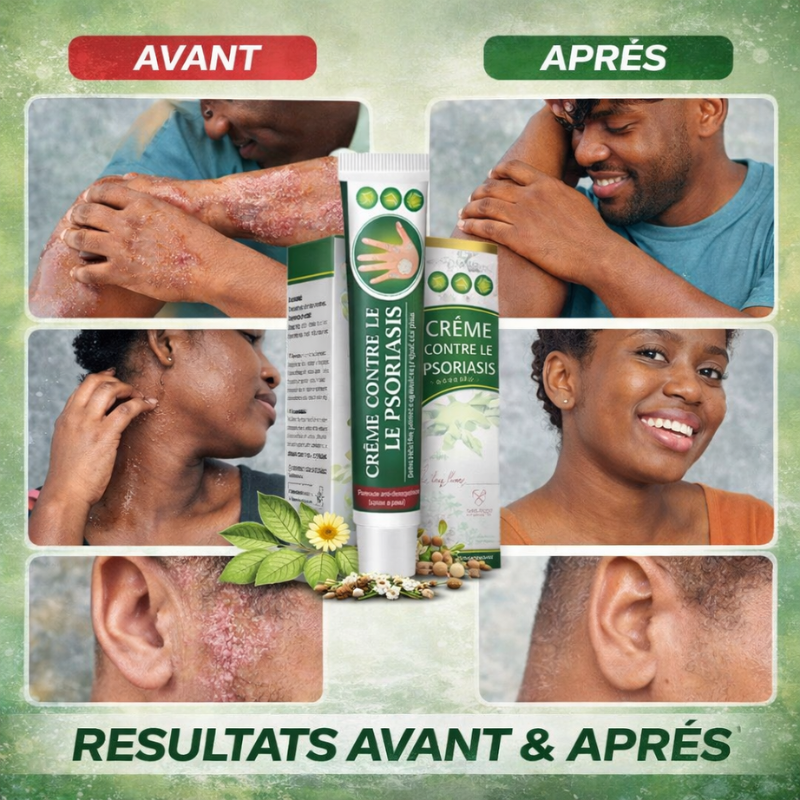 Traitement qui élimine définitivement l'eczéma, le psoriasis et les démangeaisons