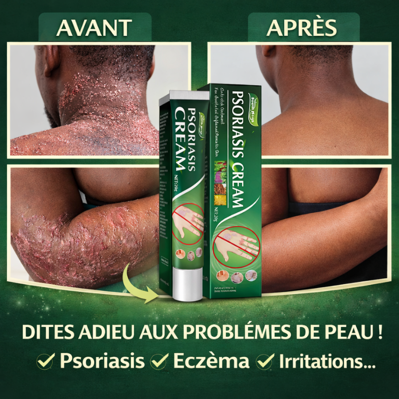 Traitement qui élimine définitivement l'eczéma, le psoriasis et les démangeaisons