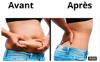 ✅ Slim Patch : minceur & brûle-graisse & amincissant (1 carton acheté =1 carton offert)